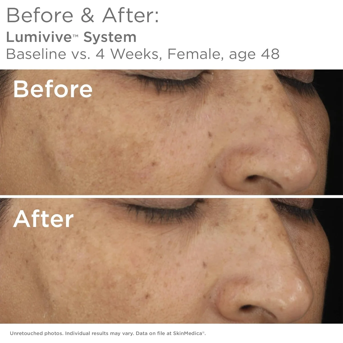 SkinMedica LUMIVIVE Day Damage Defense Serum
