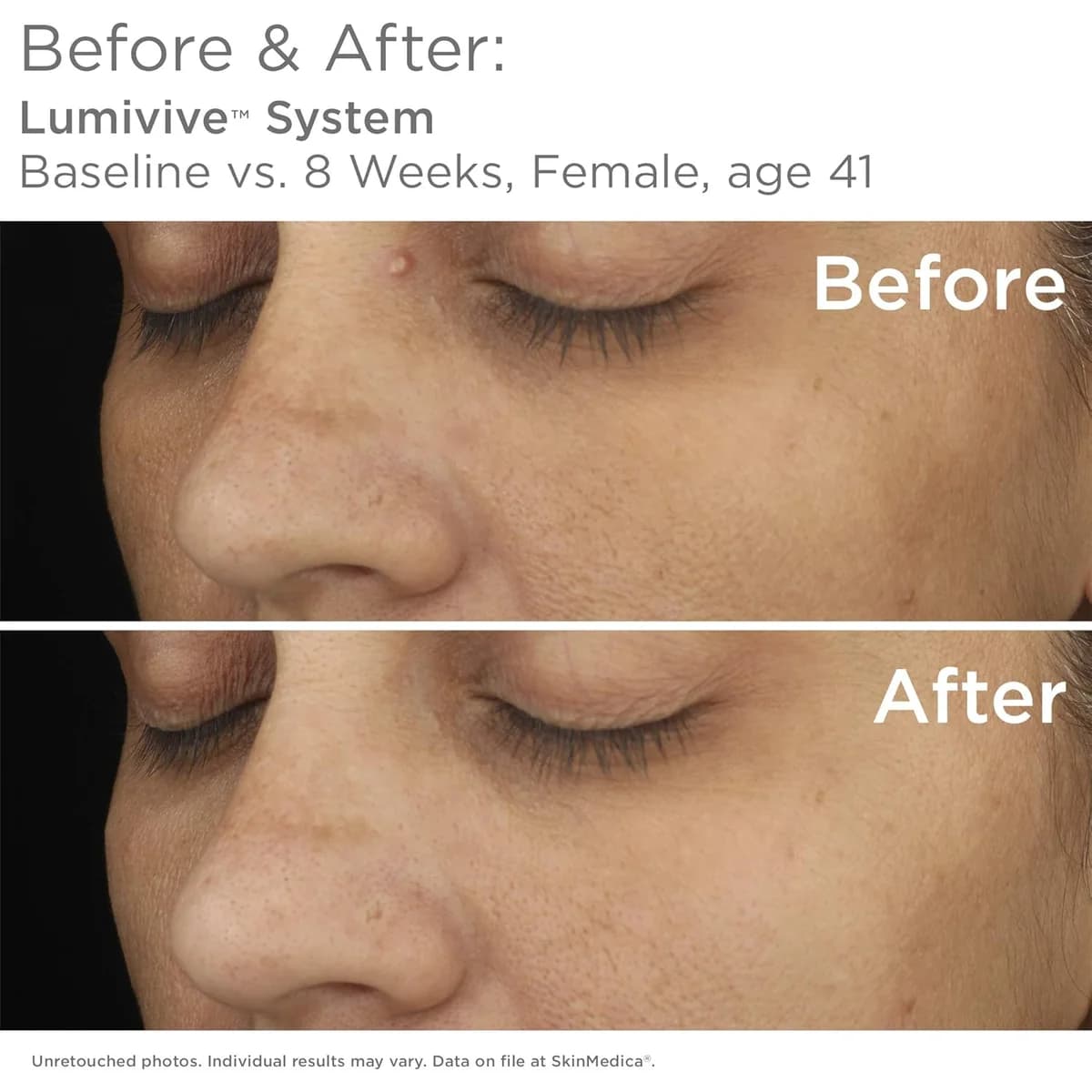 SkinMedica LUMIVIVE Day Damage Defense Serum