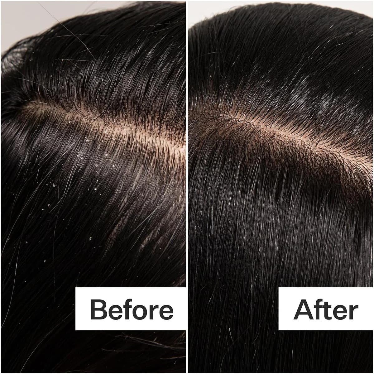 Act+Acre Cold Processed Scalp Detox