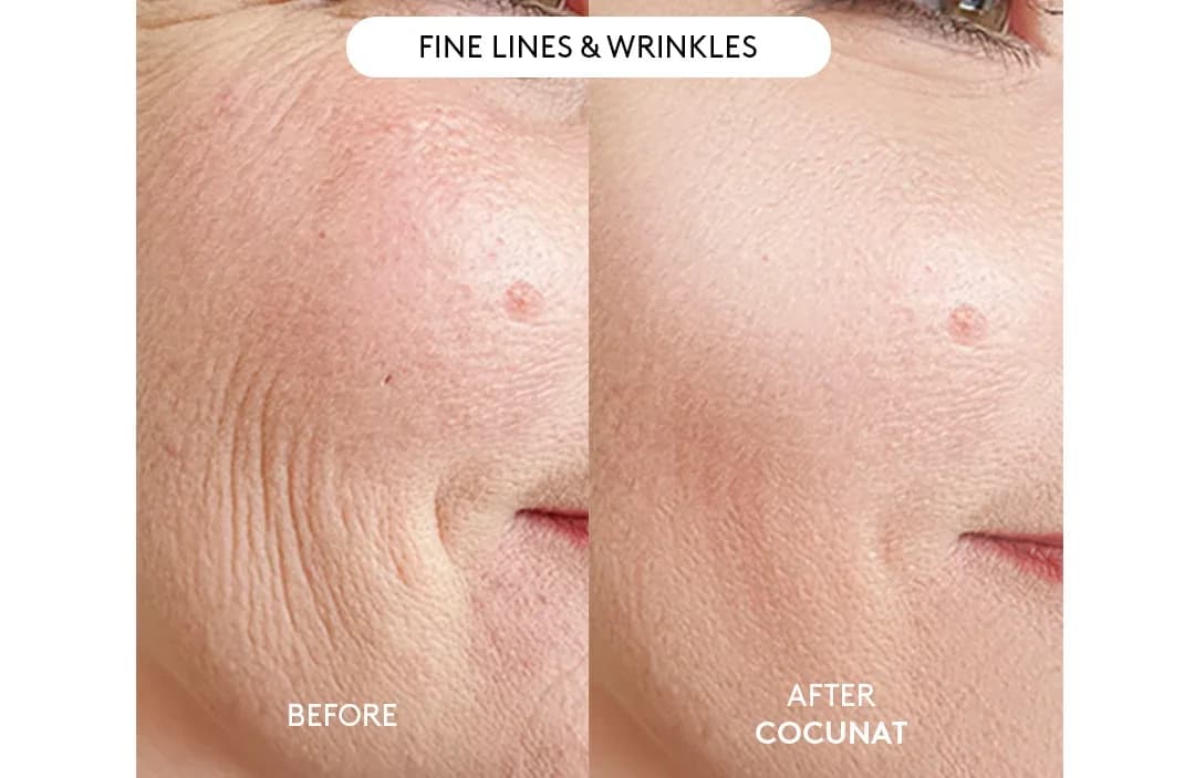 Cocunat Clinical Beauty Filler